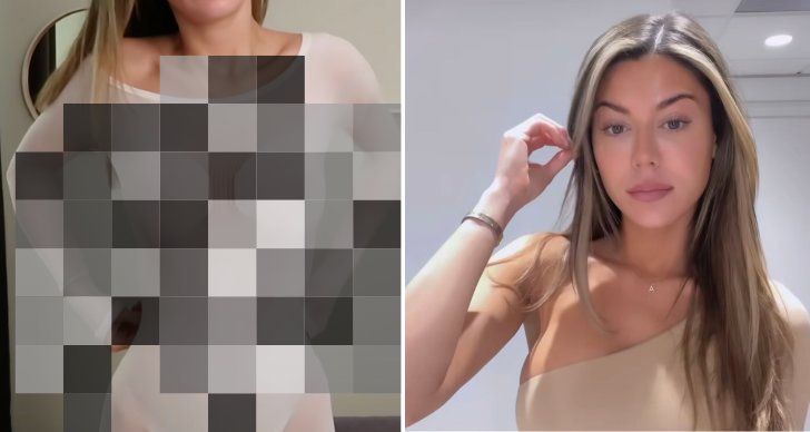 Bianca Ingrosso visar upp dyra skönhetsbehandlingen – så många tusenlappar kostar den